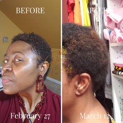 Ayurvedic Hair Growth Potion for Maximum Hair Regrowth