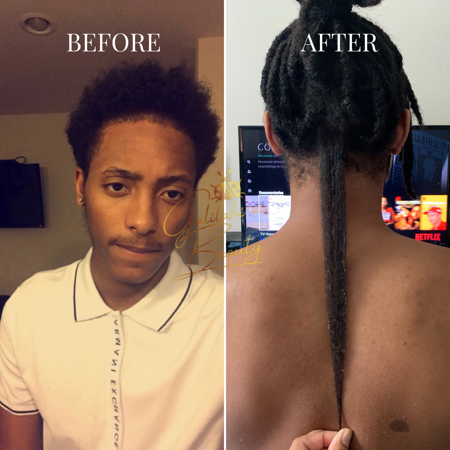 Ayurvedic Hair Growth Potion for Maximum Hair Regrowth