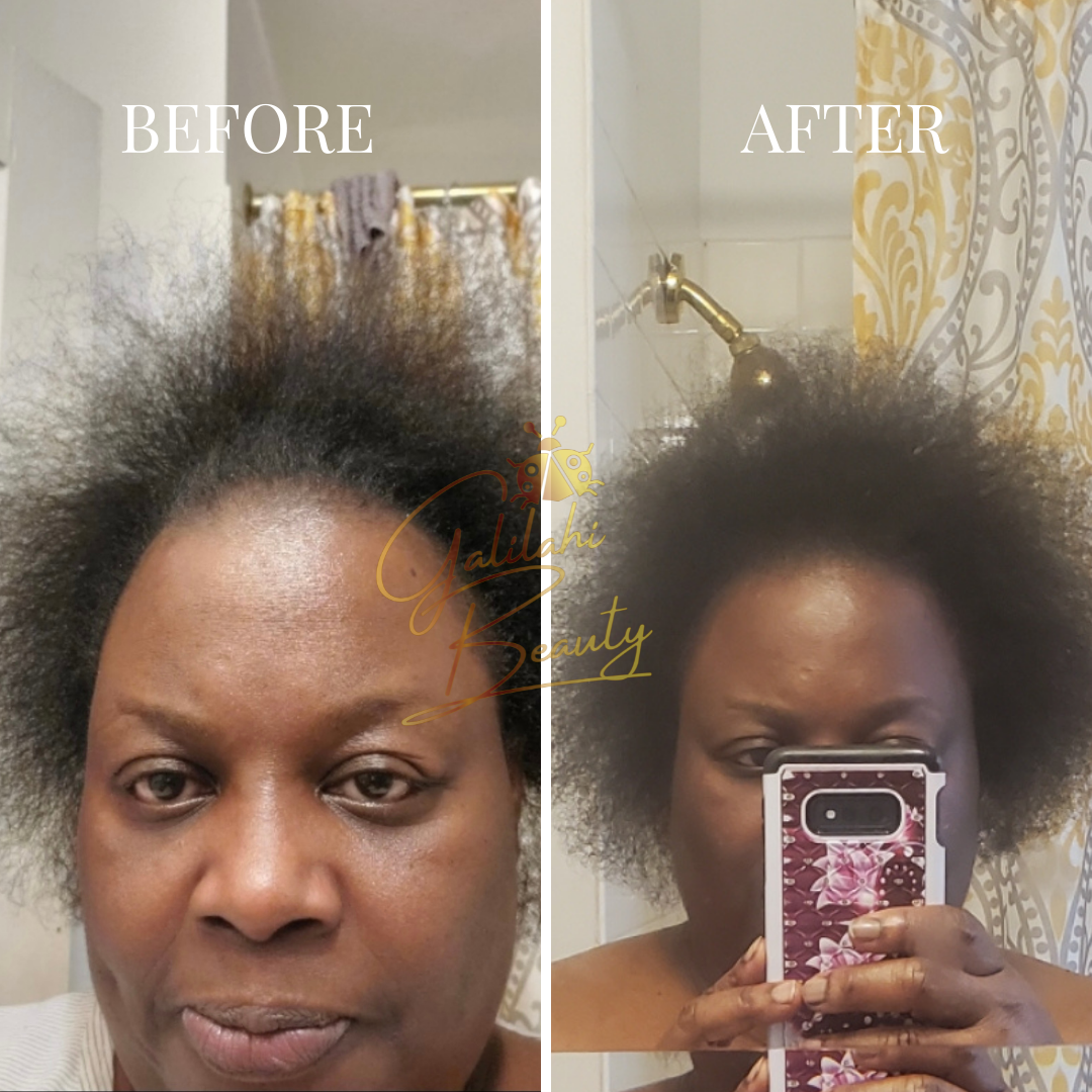 Ayurvedic Hair Growth Potion for Maximum Hair Regrowth