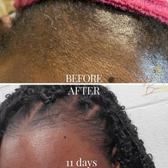 Ayurvedic Hair Growth Potion for Maximum Hair Regrowth